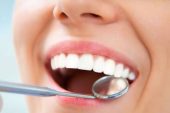 Dentist Bucuresti – interventii profesionale